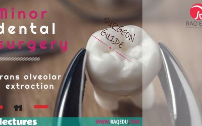 Dental surgery / Minor surgery / Trans-alveolar extraction