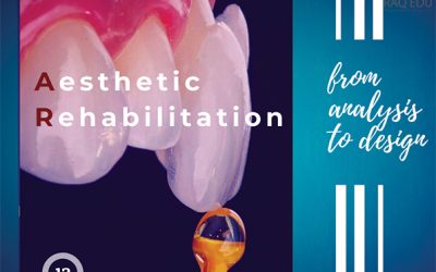 Esthetic rehabilitation