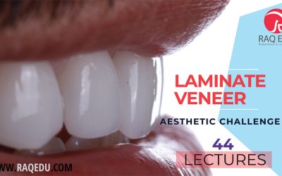 Laminate veneers / Full Package